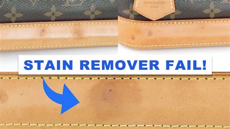 remove water stains from Louis Vuitton leather